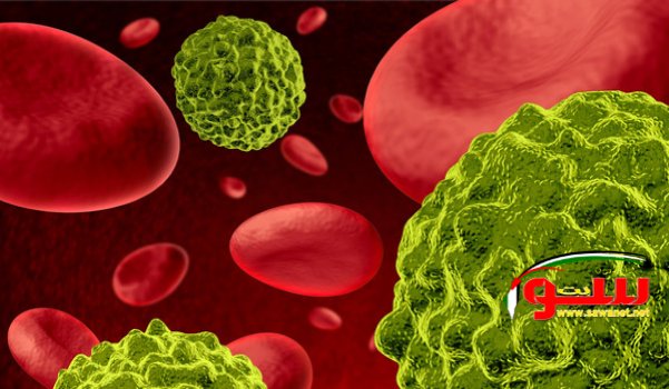 Ø§Ø³ØªØ®Ø±Ø§Ø¬ ØµØ¨ØºØ© Ù…Ù† 