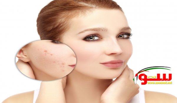  9 Ø£Ø³Ø¨Ø§Ø¨ Ø®ÙÙŠÙ‘Ø© Ù„Ù…Ø´ÙƒÙ„Ø© Ø­ÙŽØ¨Ù‘ Ø§Ù„Ø´Ù‘Ø¨Ø§Ø¨ .. Ø§ÙƒØªØ´ÙÙÙˆÙ‡Ø§ Ø§Ù„Ø¢Ù† ÙˆØªØ¬Ù†Ù‘Ø¨ÙˆÙ‡Ø§ | Ù…ÙˆÙ‚Ø¹ Ø³ÙˆØ§ 