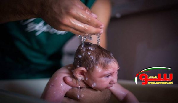 Ø²ÙŠÙƒØ§ ØªØ³Ø¨Ù‘Ø¨ ÙÙ‚Ø¯Ø§Ù† Ø§Ù„Ø³Ù…Ø¹! | Ù…ÙˆÙ‚Ø¹ Ø³ÙˆØ§ 