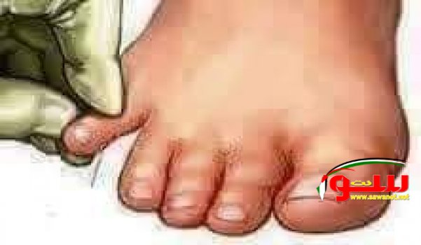 Ø´ÙŠØ¡ Ù…Ø¯Ù‡Ø´ :Ù…Ø§ Ø³Ø± ÙØ§Ø¦Ø¯Ø© Ø§Ù„Ø¶ØºØ· Ø¹Ù„Ù‰ Ø§Ù„Ø§ØµØ¨Ø¹ Ø§Ù„ØµØºÙŠØ± ... | Ù…ÙˆÙ‚Ø¹ Ø³ÙˆØ§ 