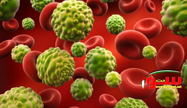 Ø¯Ù„Ø§Ø¦Ù„ Ù„Ù„Ø¥ØµØ§Ø¨Ø© Ø¨Ø§Ù„Ø³Ø±Ø·Ø§Ù† Ø¯ÙˆÙ† Ø¥Ø¬Ø±Ø§Ø¡ ÙØ­ÙˆØµØ§Øª | Ù…ÙˆÙ‚Ø¹ Ø³ÙˆØ§ 