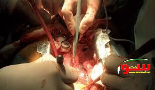 Ø¨Ø­Ø« Ø¥Ø¹Ø¯Ø§Ø¯ Ù…Ø´Ø±ÙˆØ¹ Ù‚Ø±Ø§Ø± Ø¨Ù‚Ø§Ù†ÙˆÙ† Ø¨Ø´Ø£Ù† Ù†Ù‚Ù„ Ø§Ù„Ø£Ø¹Ø¶Ø§Ø¡ Ø§Ù„Ø¨Ø´Ø±ÙŠØ© | Ù…ÙˆÙ‚Ø¹ Ø³ÙˆØ§ 