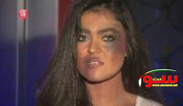 Ø¨Ø§Ù„ÙÙŠØ¯ÙŠÙˆ.. Ø³Ø± Ø§Ù„ÙƒØ¯Ù…Ø§Øª Ø¹Ù„Ù‰ ÙˆØ¬Ù‡ Ù…Ø°ÙŠØ¹Ø© ØªÙ„ÙØ²ÙŠÙˆÙ† Ø§Ù„Ø¢Ù†..!ØŸ | Ù…ÙˆÙ‚Ø¹ Ø³ÙˆØ§ 