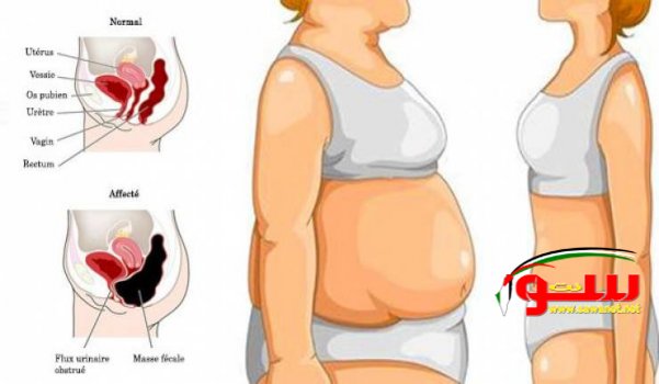 5 Ù†ØµØ§Ø¦Ø­ Ù„ØªÙ‚ÙˆÙ„ÙˆØ§ ÙˆØ¯Ø§Ø¹Ø§ Ù„Ø¯Ù‡ÙˆÙ† Ø§Ù„Ø¨Ø·Ù† | Ù…ÙˆÙ‚Ø¹ Ø³ÙˆØ§ 