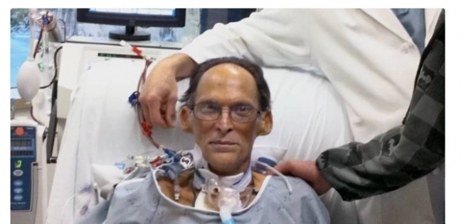 Ø£ÙˆÙ„ Ø§Ù†Ø³Ø§Ù† ÙŠØ¹ÙŠØ´ Ø¨Ù„Ø§ Ù‚Ù„Ø¨ Ù„Ù…Ø¯Ø© Ø´Ù‡Ø± ÙƒØ§Ù…Ù„ ÙÙŠ ØªØ§Ø±ÙŠØ® Ø§Ù„Ø¨Ø´Ø±ÙŠÙ‡... | Ù…ÙˆÙ‚Ø¹ Ø³ÙˆØ§ 